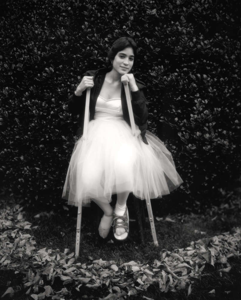 Sally Mann, Debbie's Broken Foot (At Twelve), 1983-1985