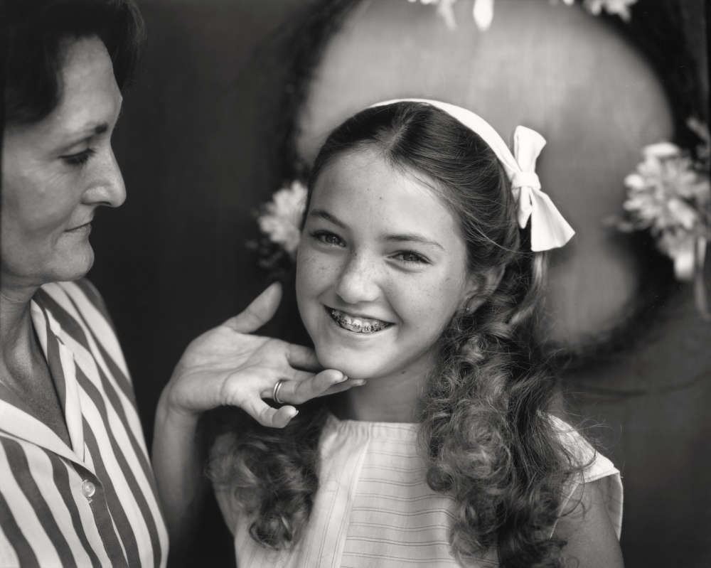 Sally Mann, Little Miss Rockbridge Gets Braces (At Twelve), 1983-1985