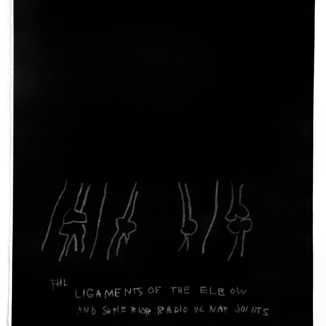 Jean Michel Basquiat “Ligaments of the Elbow” plate from the Anatomy Series, 1984 Print on Arches paper 30 x 22 in. Unsigned (Artist Proof) Authenticated This work was produced in a grey and black palette, printed before Basquiat made the color values black and white and created the iconic series of 18 plates. For sale at VFA