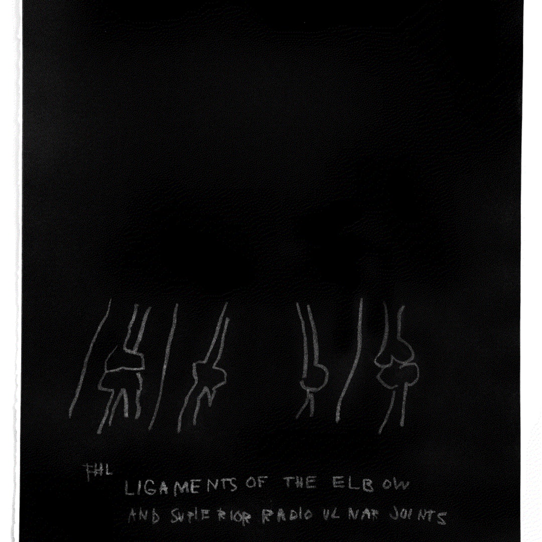 Jean-Michel Basquiat "LIGAMENTS OF THE ELBOW" PLATE FROM THE ANATOMY SERIES", 1984 Print on Arches paper 30 x 22 ins 76.2 x 55.88 cm Available at VFA