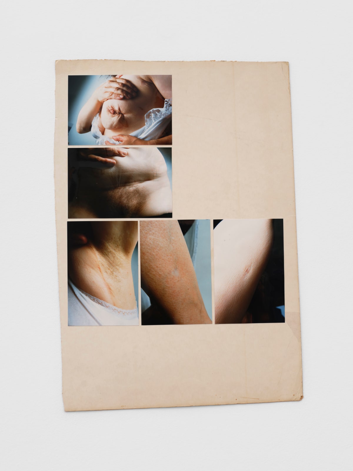 Jo SPENCE A Picture of Health?, 1983 5 colour photographs mounted on artist card, vintage 50 x 34 cm card