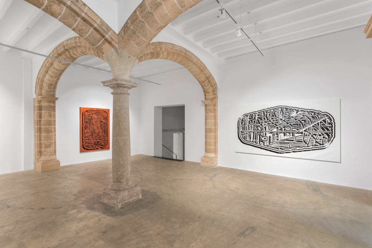 Resonancia Magnética Pablo Siquier