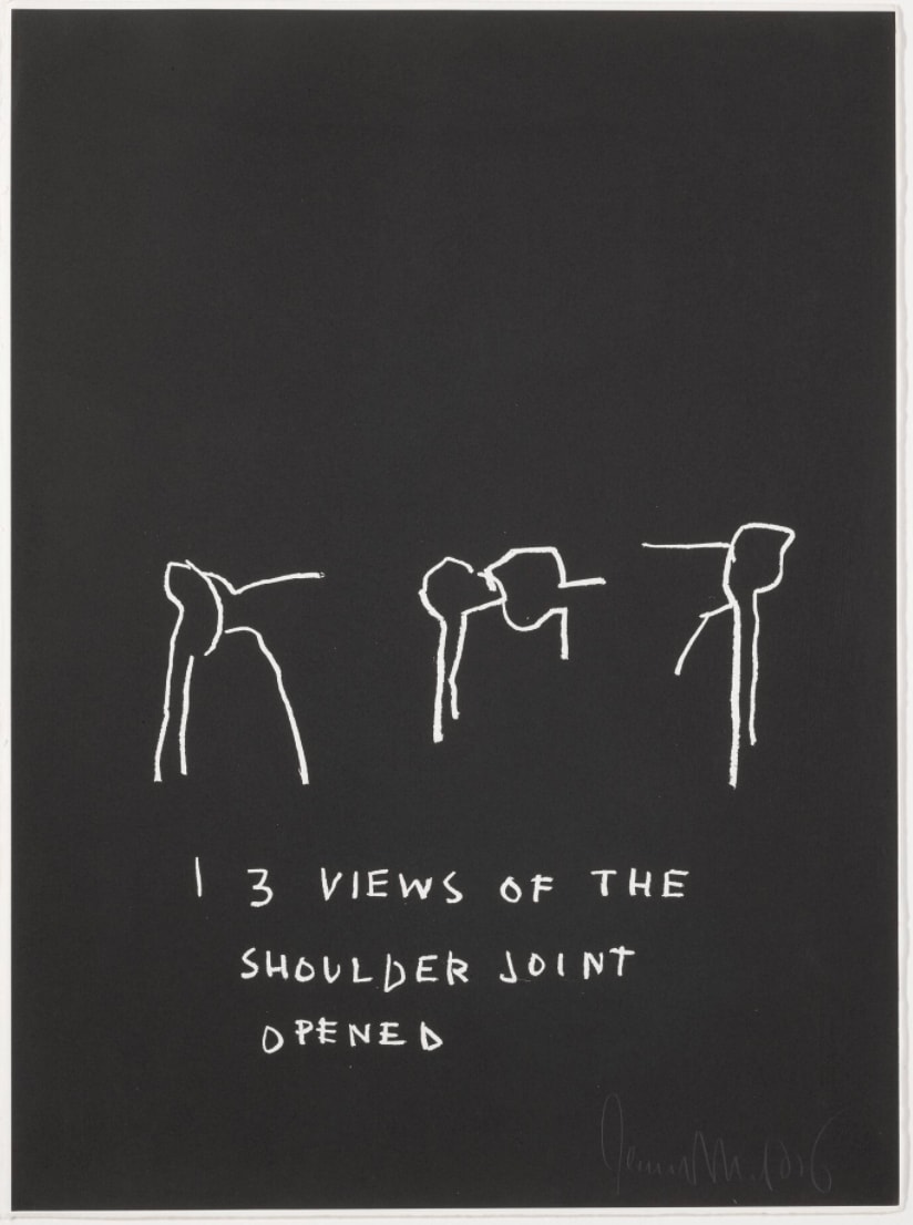 Jean-Michel Basquiat, Three Views of The Shoulder Joint Opened, from Anatomy, 1982