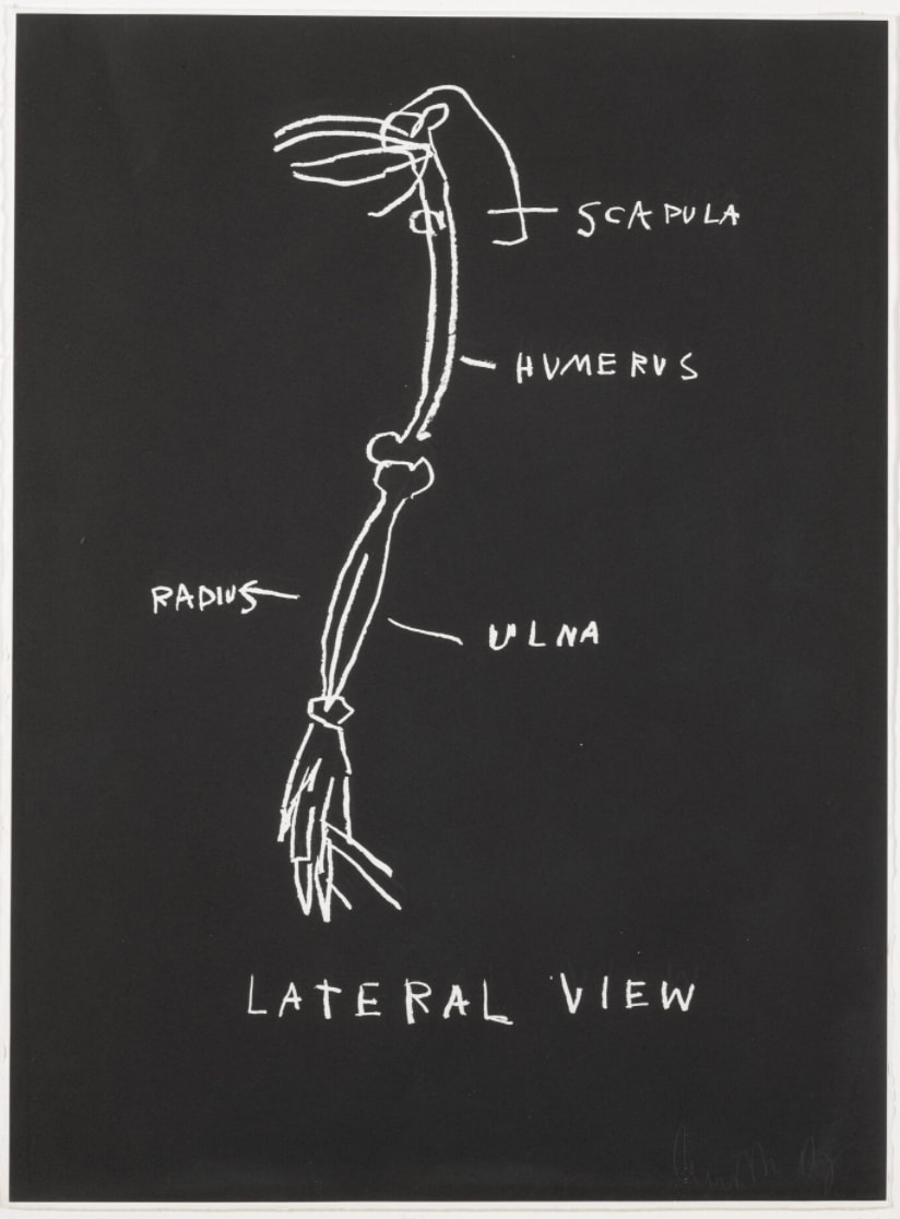 Jean-Michel Basquiat, Lateral View, from Anatomy, 1982