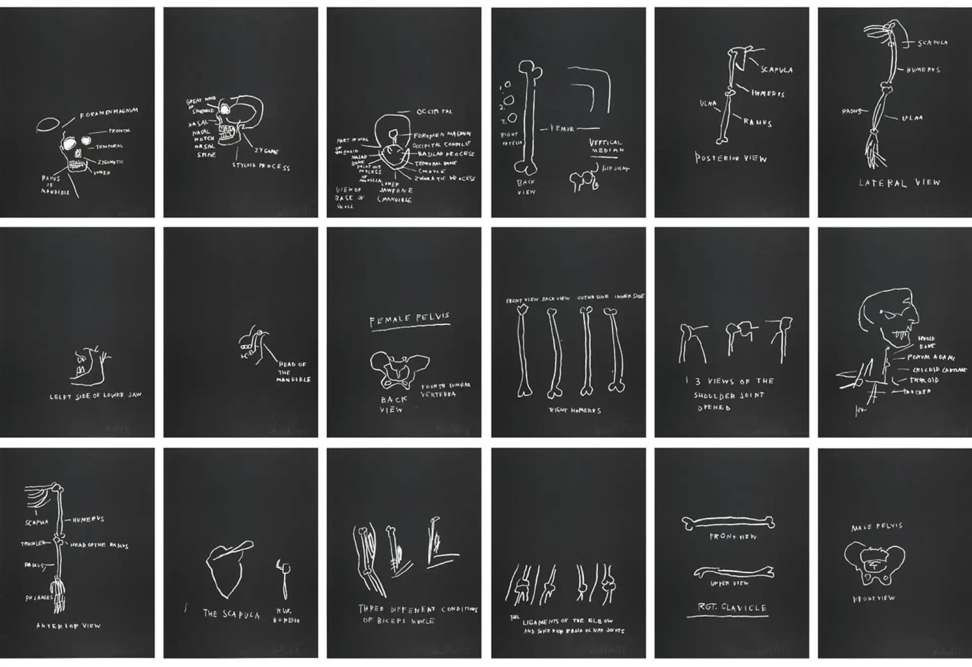 Jean-Michel Basquiat, Anatomy, 1982