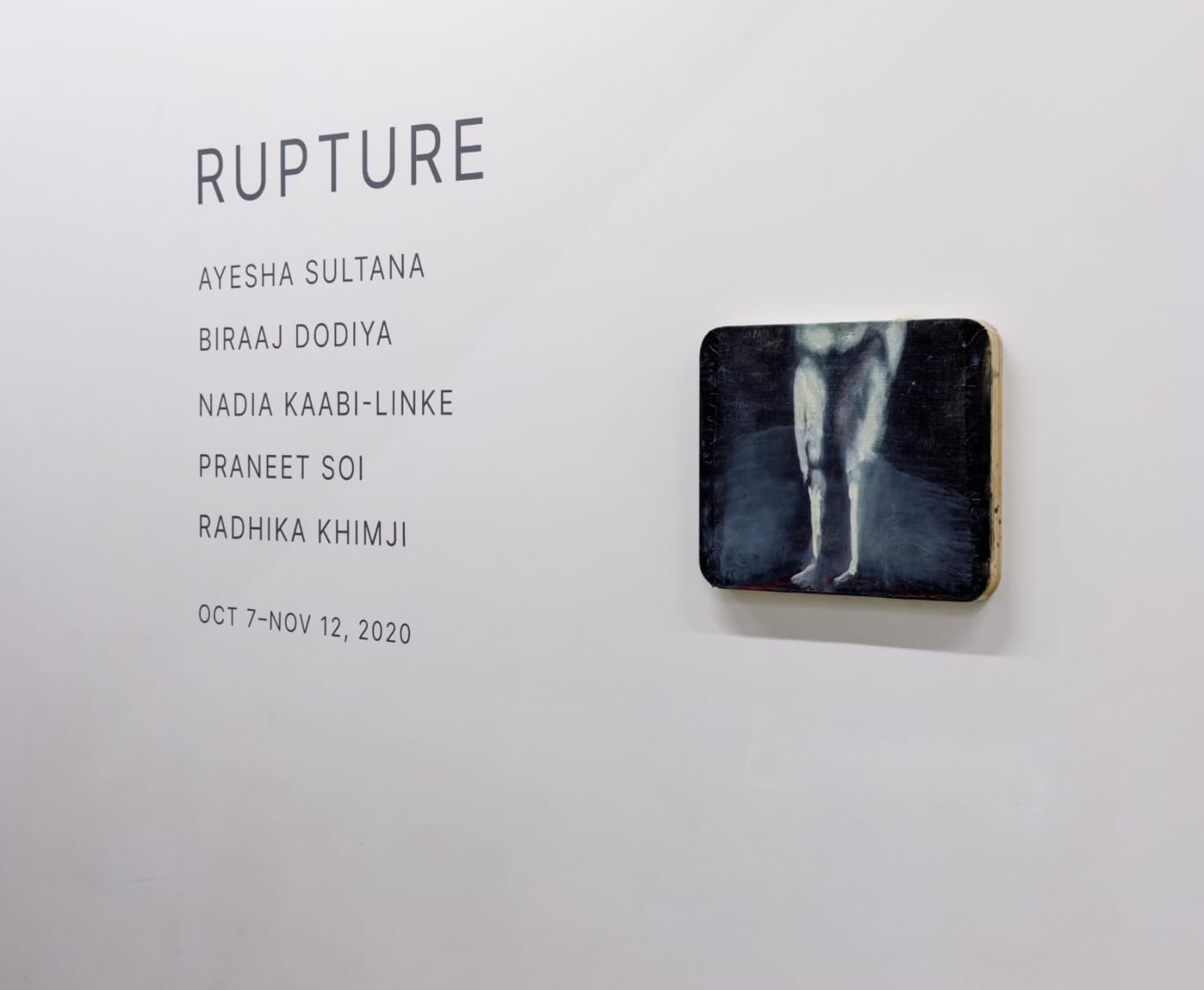 Rupture