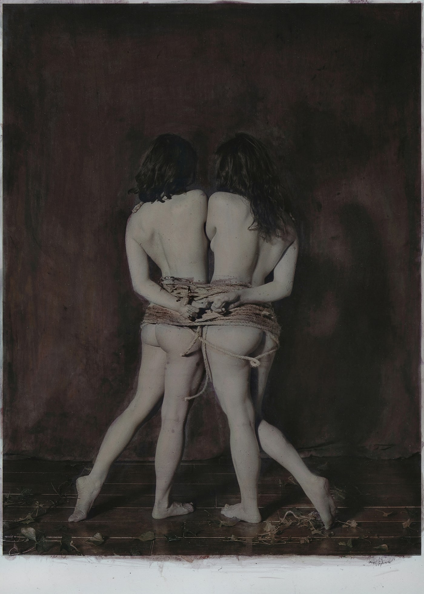 Katie Eleanor, VIII. Omphalopagus monster, an orphan, 2015