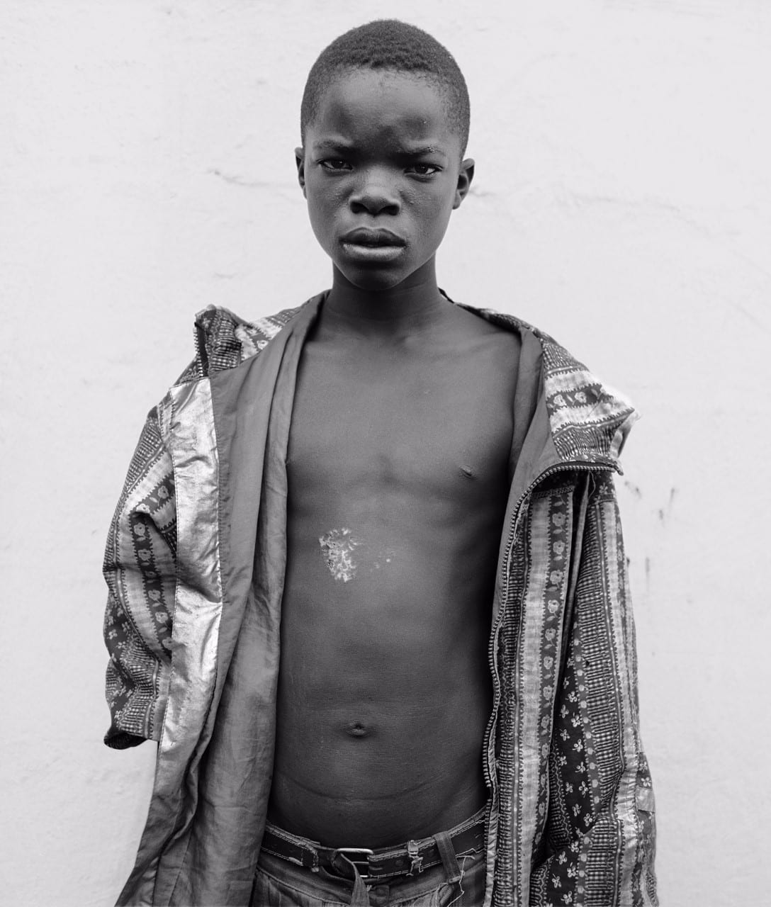 Street Child IV, Lusaka, Zambia, 1999 Pigment Print 66 x 56 cm | 26 x 22 1/8 in Edition of...