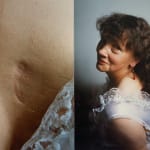Jo Spence, Photo therapy: Cultural Capital?, 1988