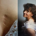 Jo Spence, Photo therapy: The Bride (from a phototherapy session on powerlessness) 3, 1984