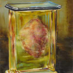 Large kidney is preserved upright in rectangular glass case.