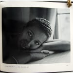 People with AIDS. Photograph