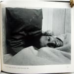 People with AIDS. Photograph