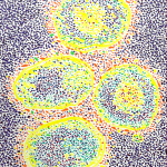 Gleb Skubachevsky, Flu, 2025