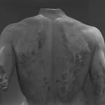 Jeff Weber, Torso Studies (The Doryphoros of Polykleitos, Roman, After the Original, ca. 450 - 440 BC), 2015