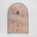 Xin Liu, Teratoma , 2019