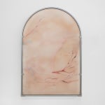 Xin Liu, Teratoma , 2019