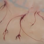 Xin Liu, Teratoma , 2019