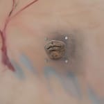 Xin Liu, Teratoma , 2019