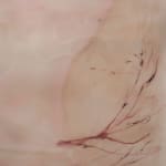 Xin Liu, Teratoma , 2019