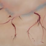 Xin Liu, Teratoma , 2019