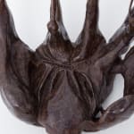 Xin Liu, Teratoma , 2019