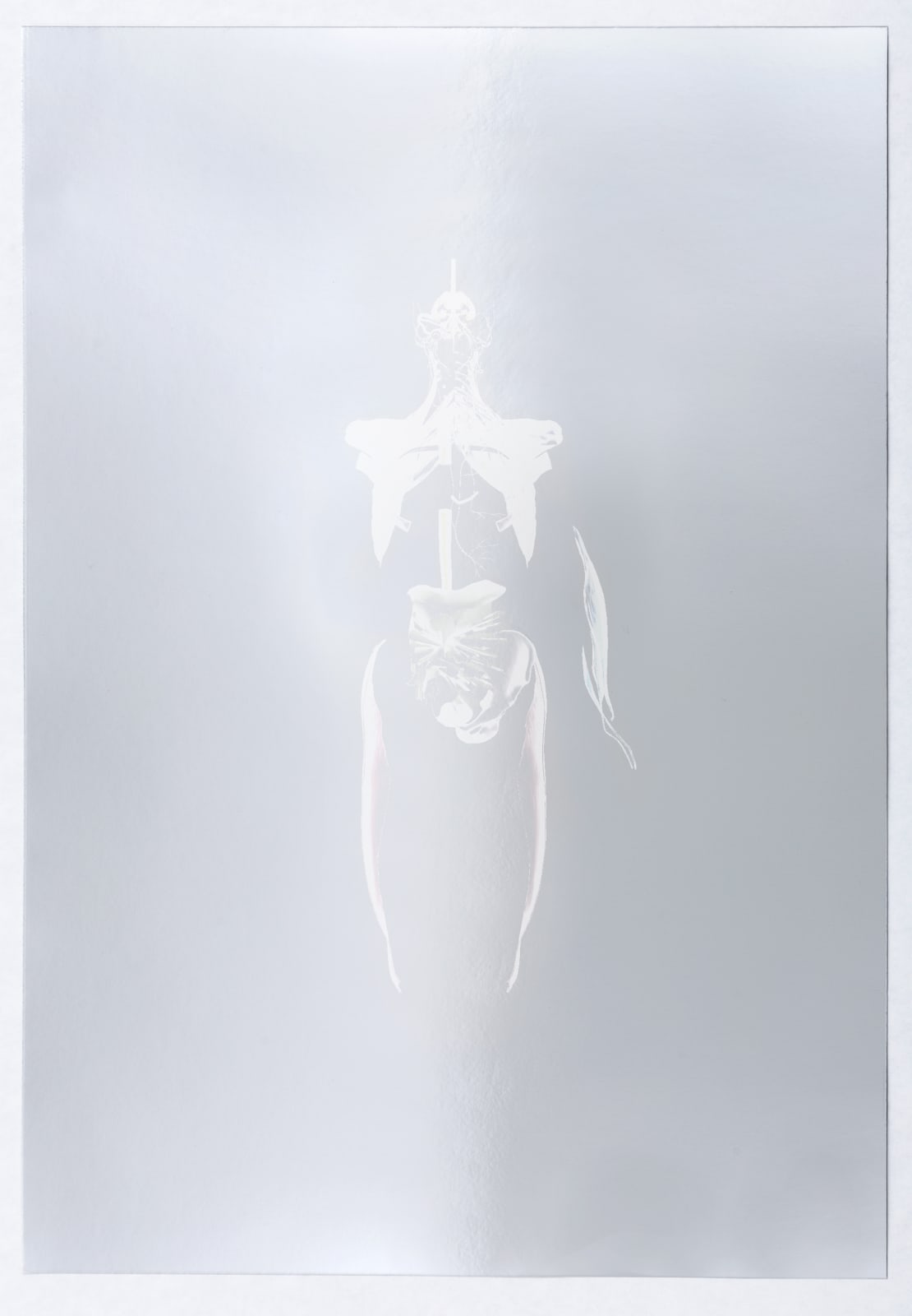 Валерия Абендрот, Urinary bladder, 2020