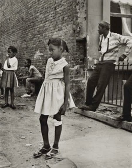 Builder Levy, Girl with Bandaged Knee, 1965