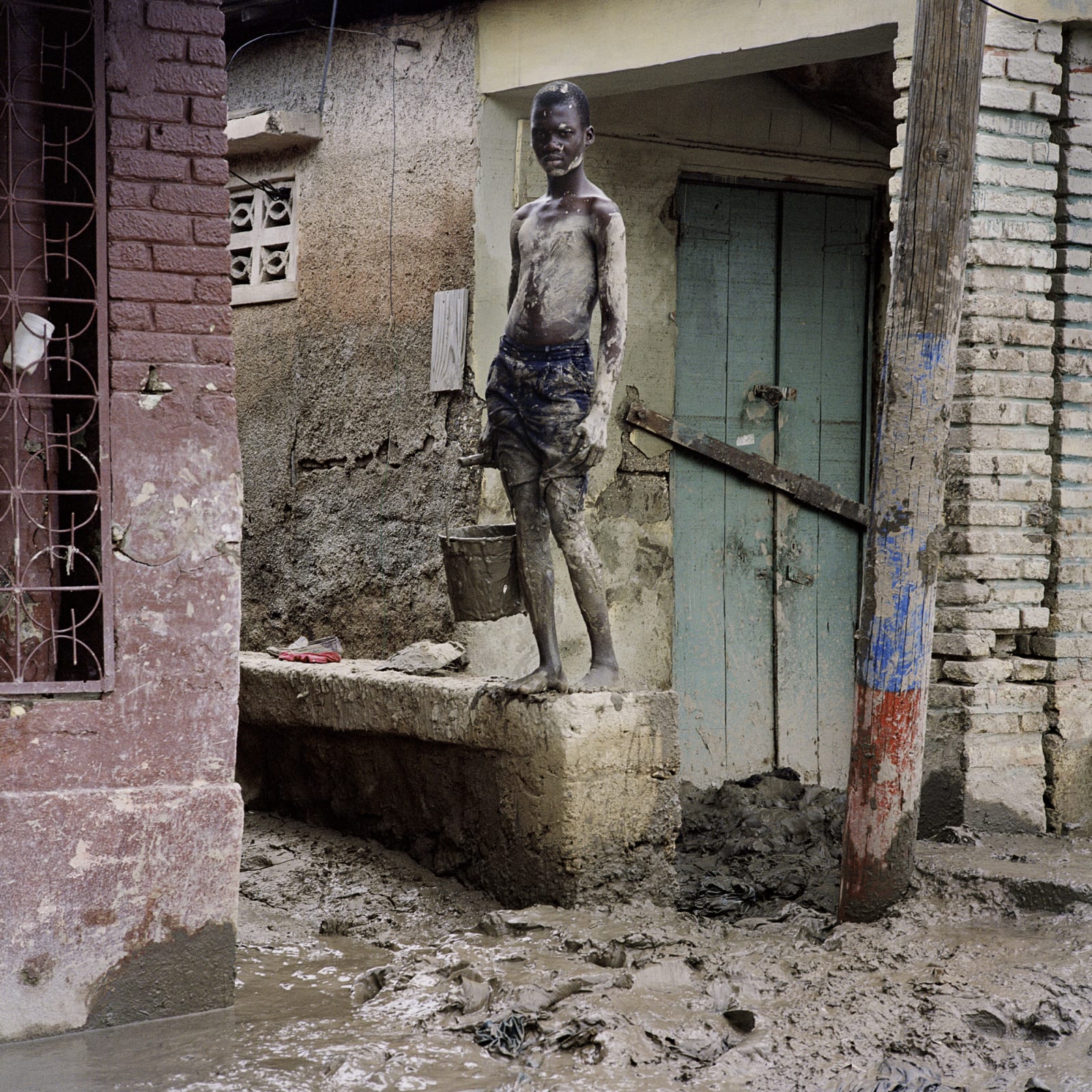 Gideon Mendel, Unnamed boy, 2008