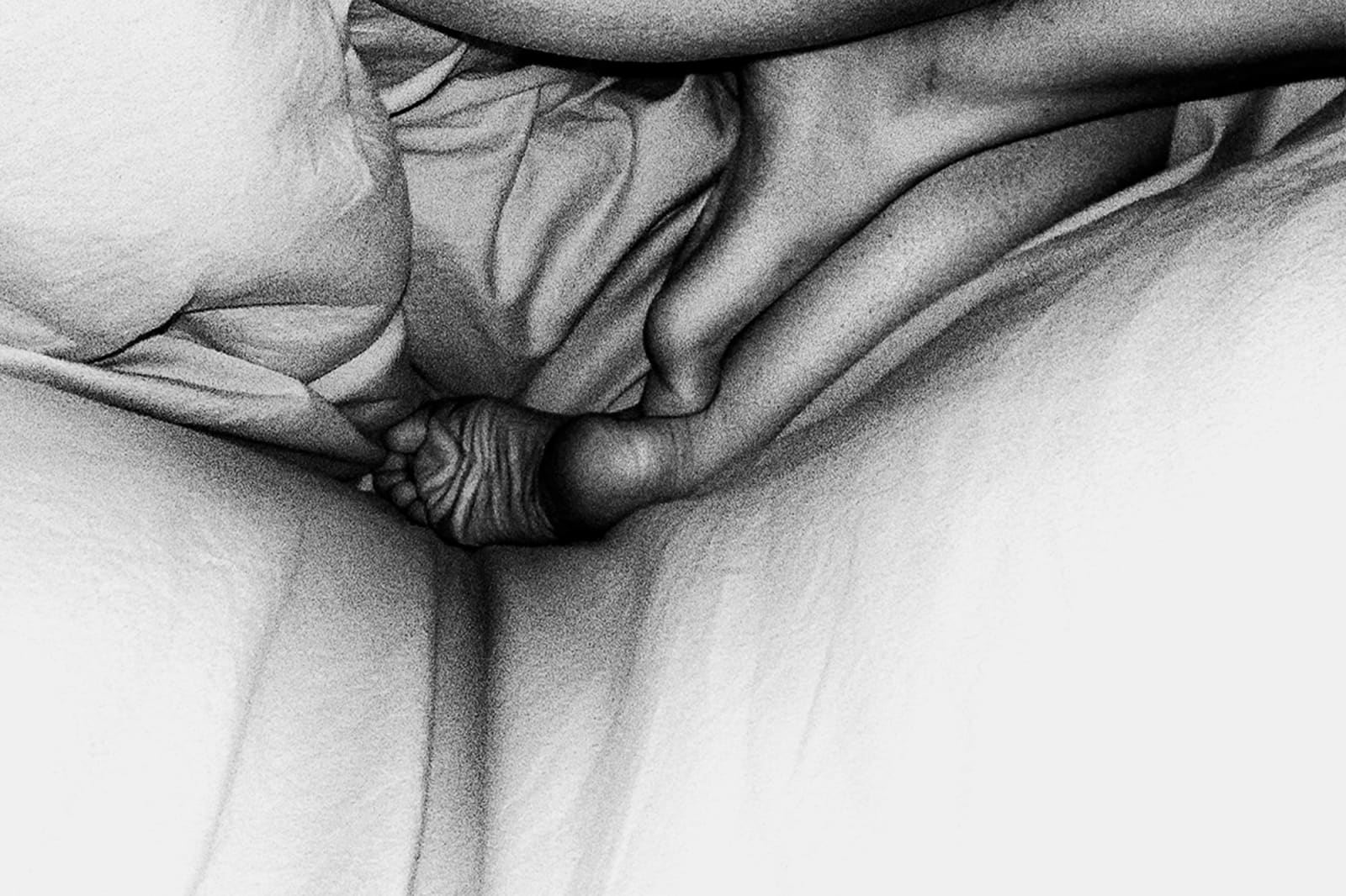 Chen Zhe 陈哲, The Bearable: Body/Wound #014可承受的:身体/伤 #014, 2008