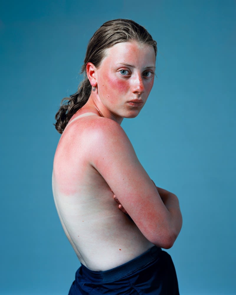 Hendrik & Paula Kerstens, Sunburnt, 2001