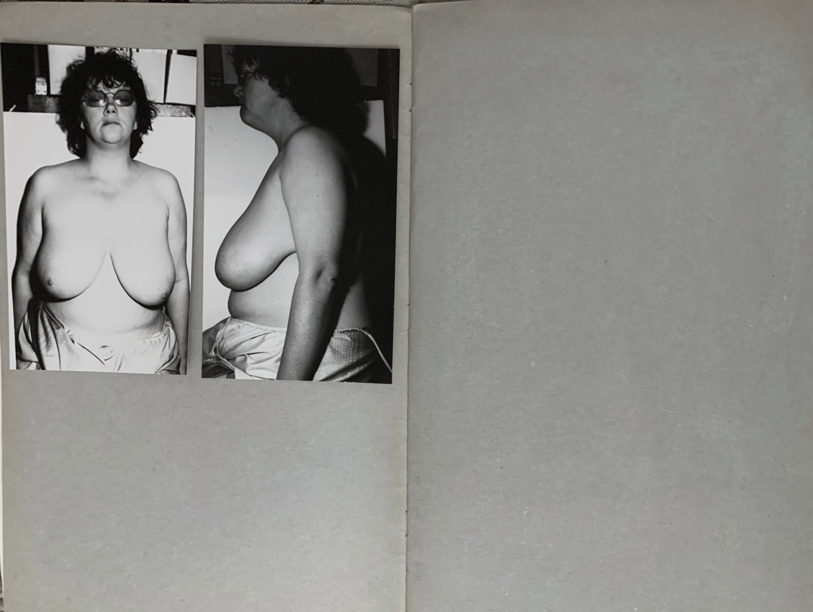 Jo Spence, Unique Artist's Book: "The History Lesson: Self as Image" (Double page 02), 1982