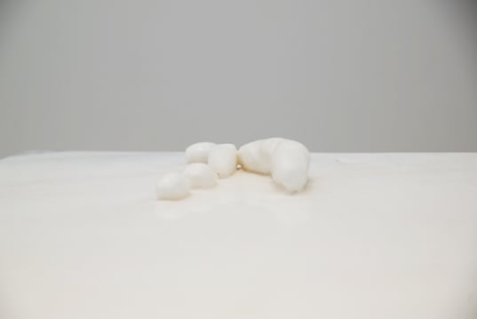 Gao Weigang, The remaining issue, 2011