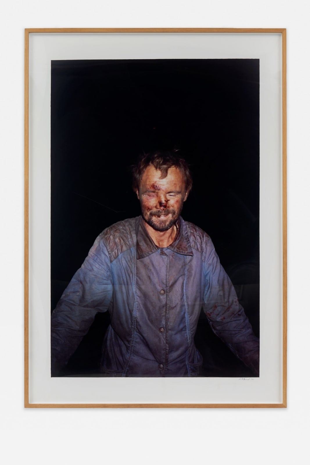 Boris Mikhailov, Untitled (from the series Case History), 1997-1998