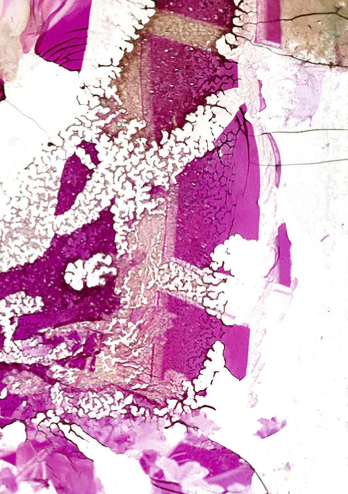 Robert Farber, Deterioration 147, 1982