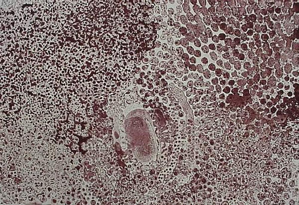 Lucy Yukenbarri, Winpurpurla , 2002