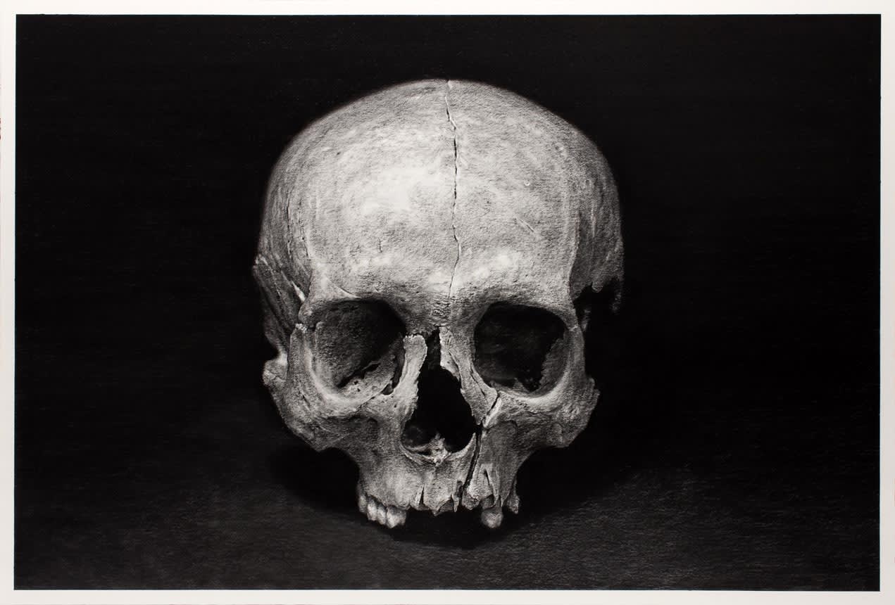 CIndy Wright, Broken bones, 2014