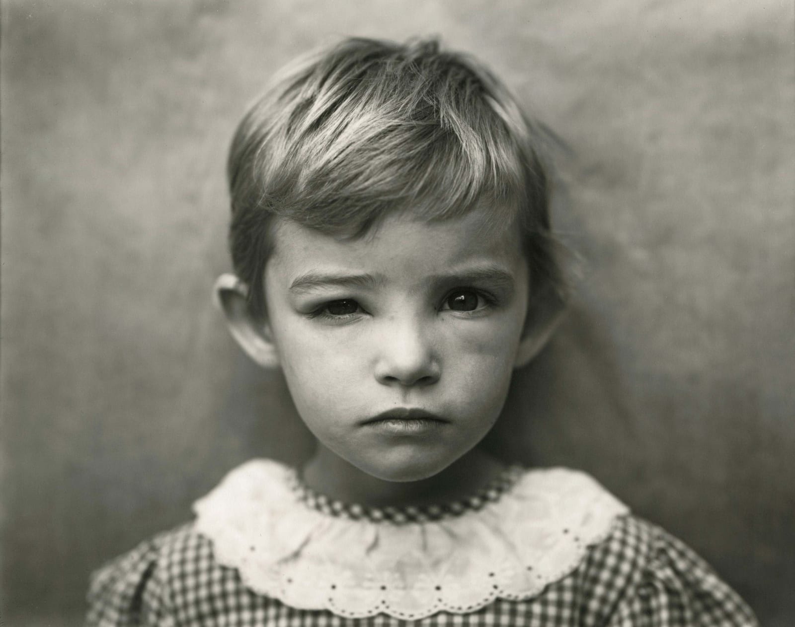 Sally Mann photograph Damaged Child from Immediate Family, portrait of daughter Jessie with swollen eye