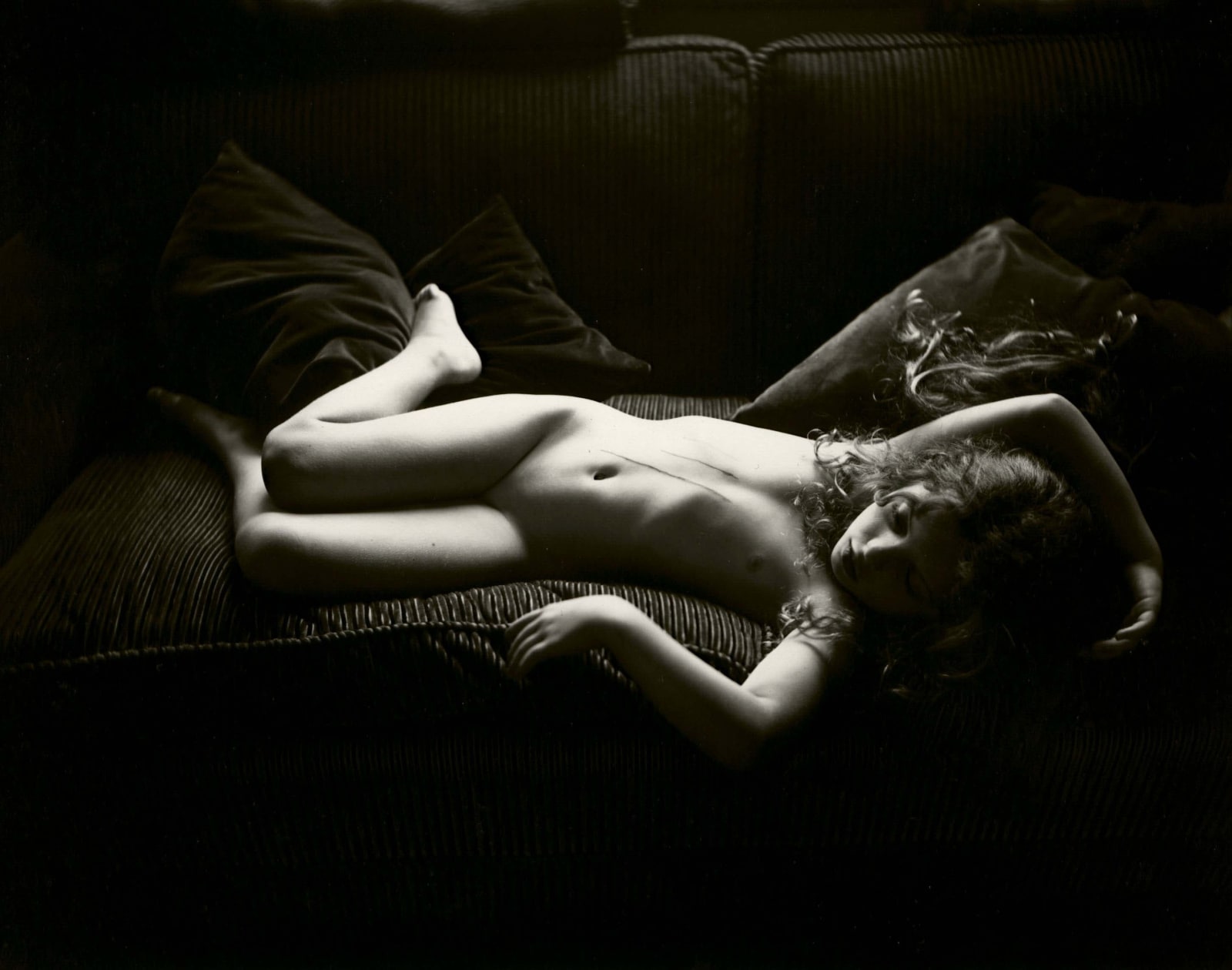 Virginia lying on couch with dog scratches on torso, from the Immediate Family series, by Sally Mann