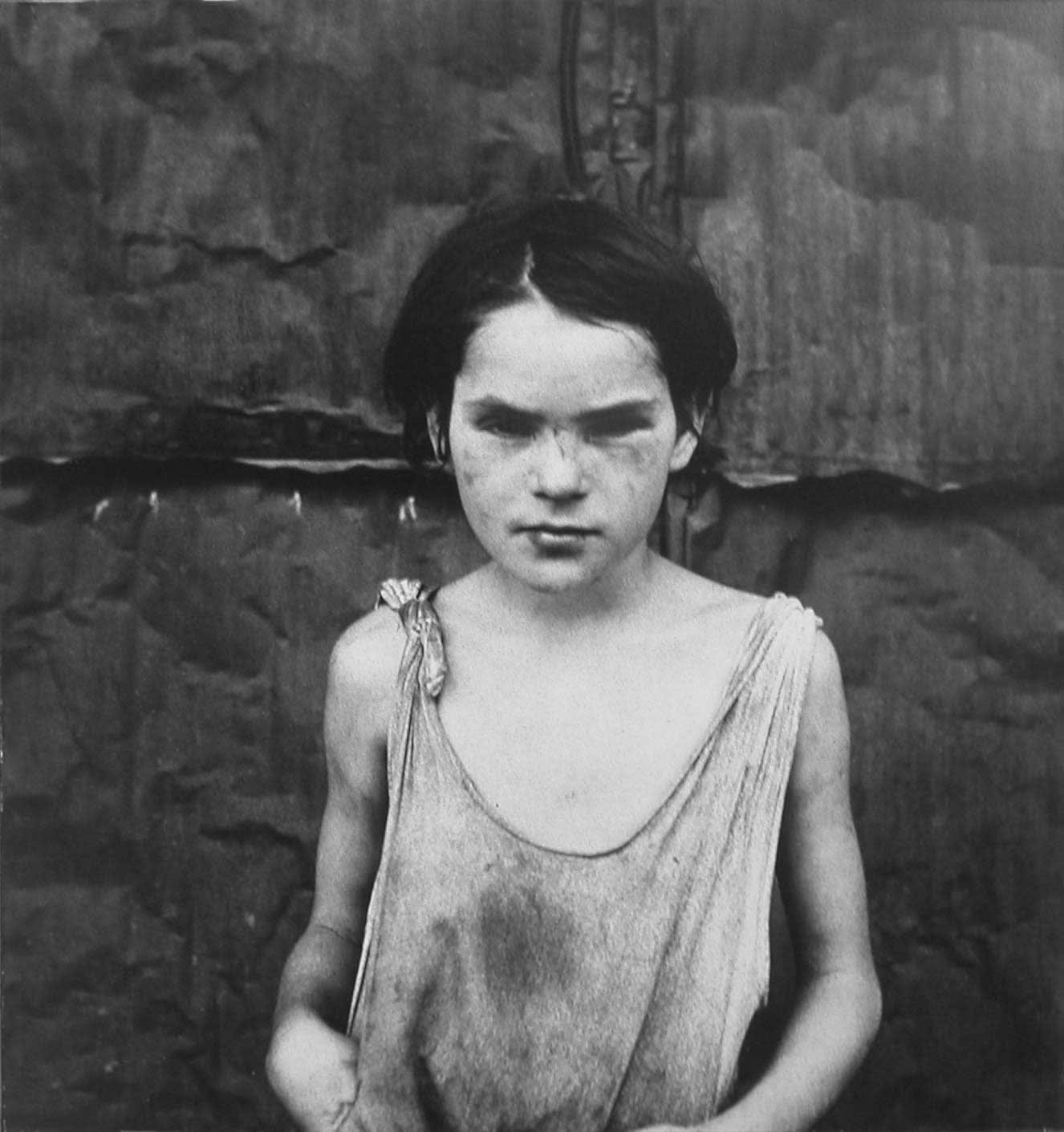 Dorothea Lange, Damaged Child, Shacktown, Elm Grove, OK, 1936