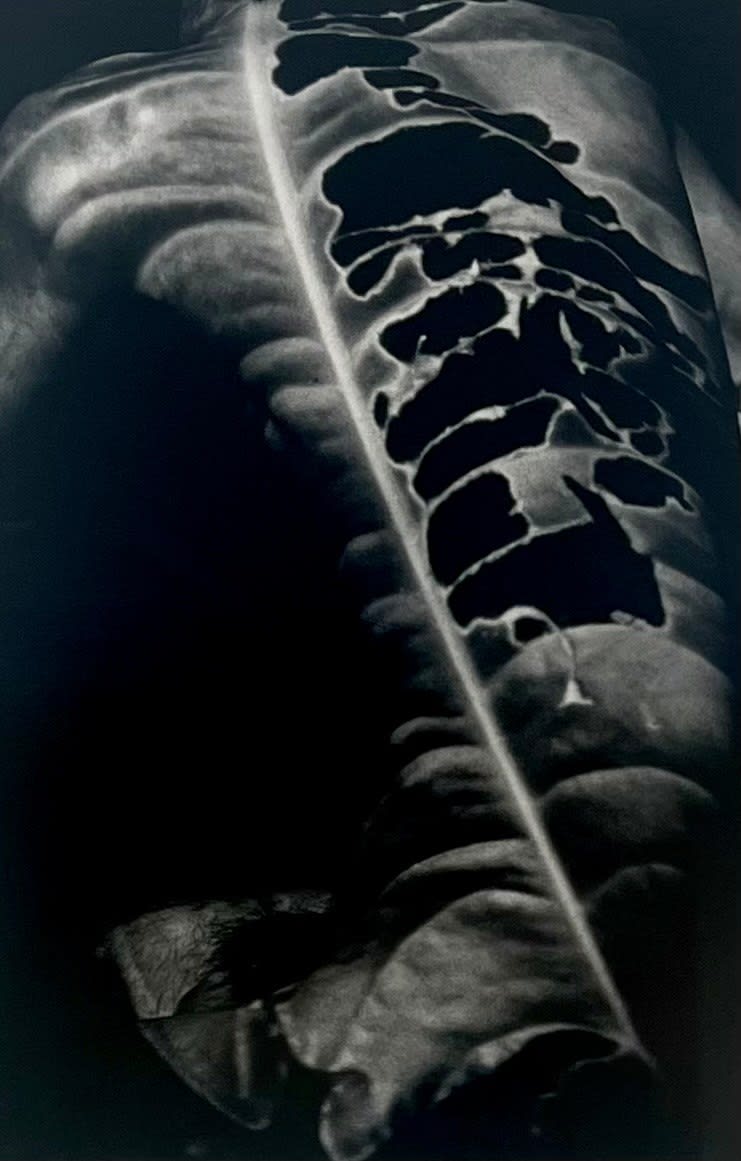 Yoko Mazuki, Chrysalis, 2001