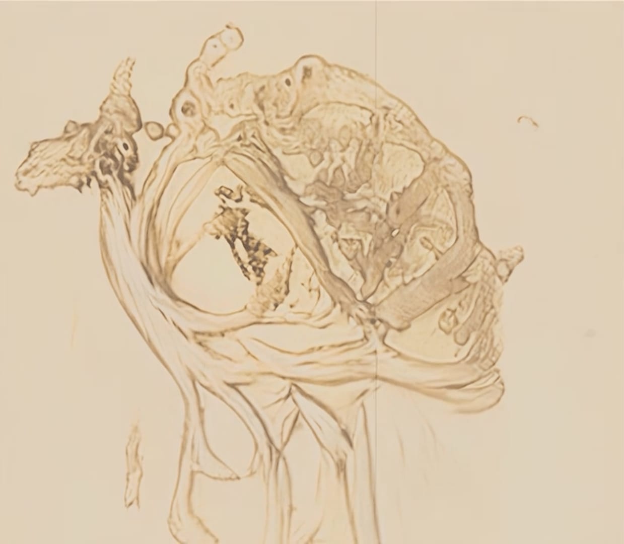 MATTHEW RITCHIE, Caudex, 2022