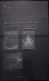 Emily Velez Nelms, Coins and Pearls Over Julia Tuttle Causeway, 2022