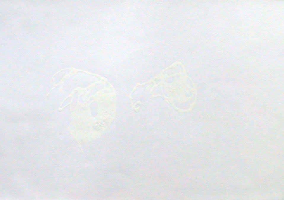 Joseph La Piana, Albino Embryos, 2004