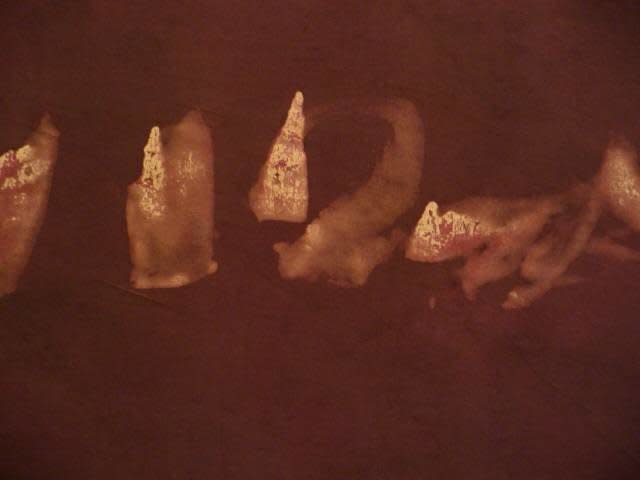 Judit Reigl, Déroulement (fragment), 1974 - 2009