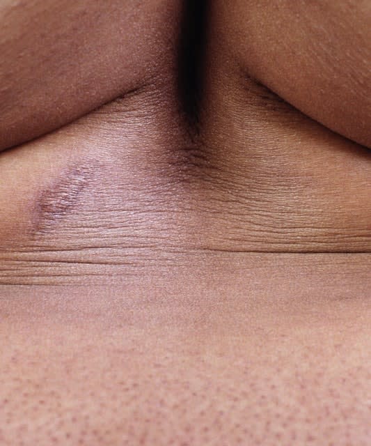 Allana Clarke, Untitled, 2021