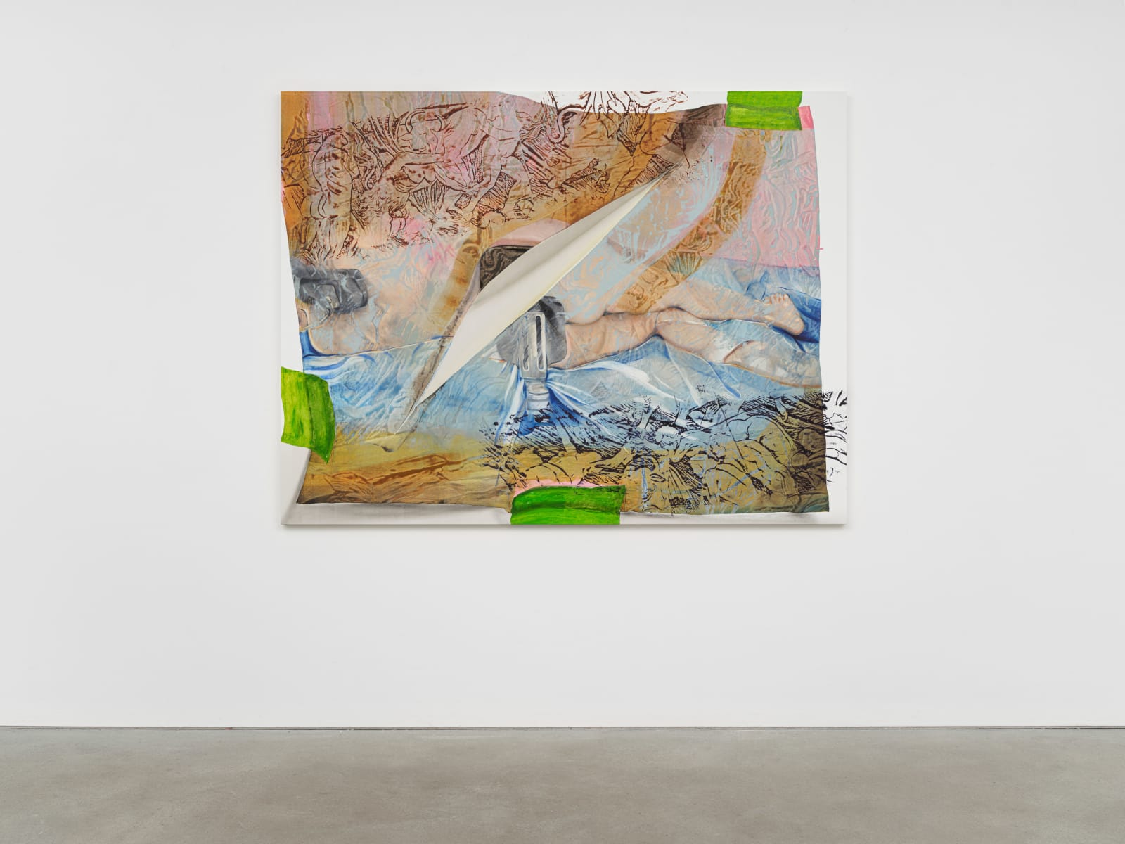 Alex Carver, The Patient is Positioned and Draped, 2024