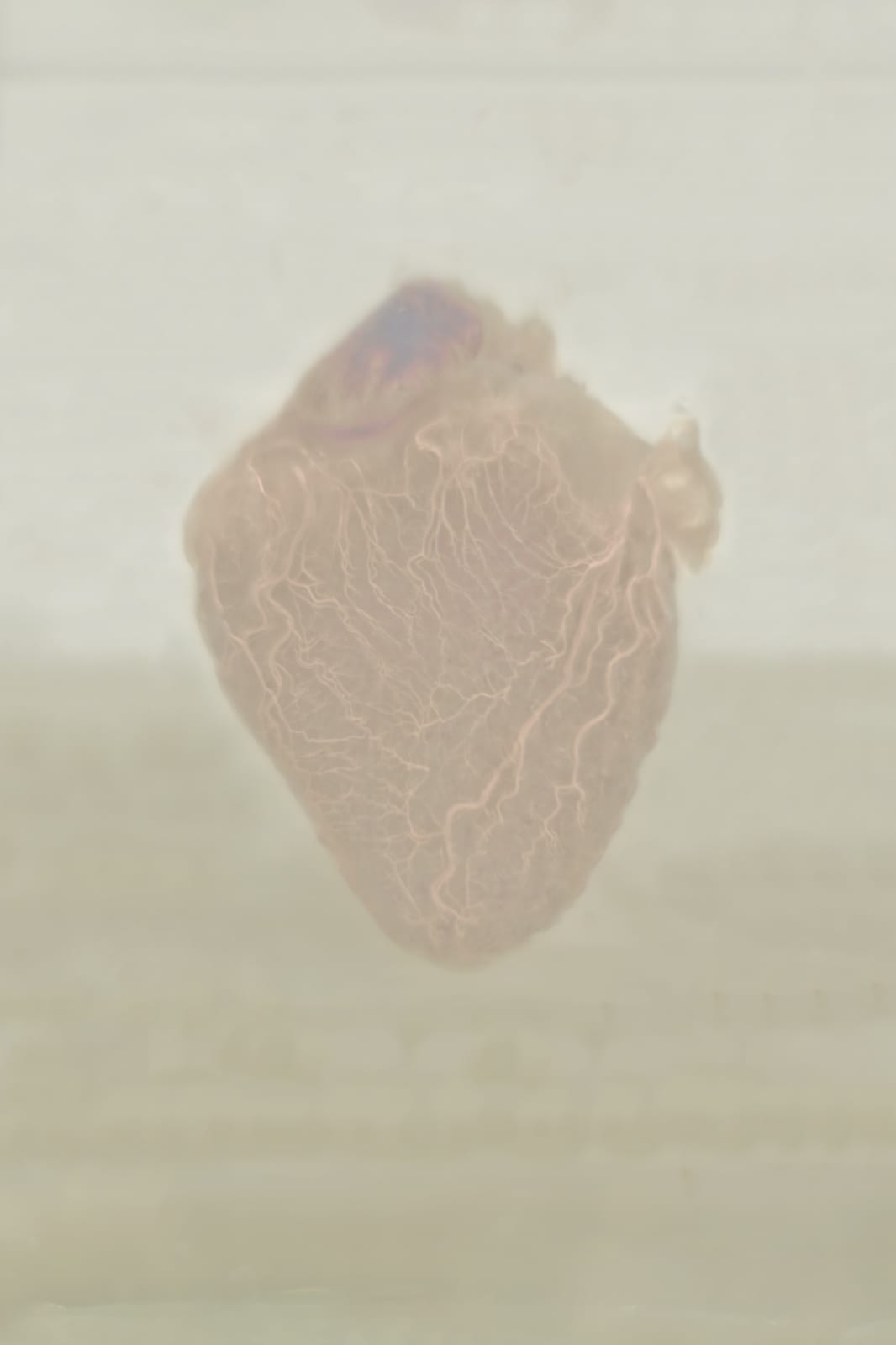Daniel Malva, Homo sapiens: cor, 2010