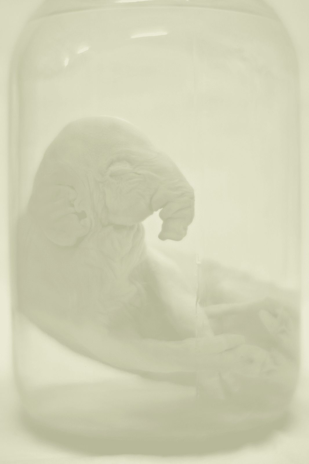 Daniel Malva, Elephas maximus: fetus, 2014