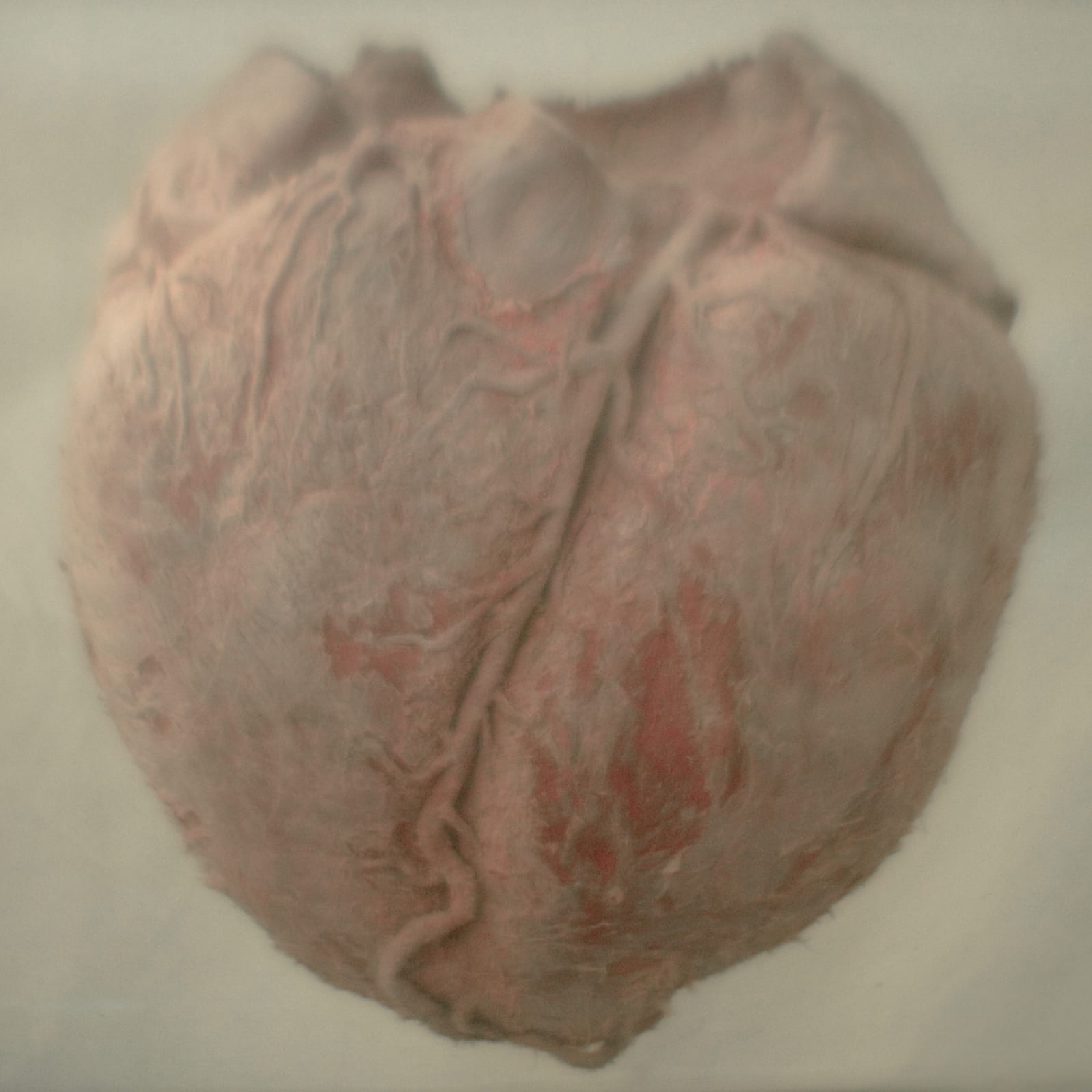 Daniel Malva, Balaenoptera bonaerensis: cor, 2009